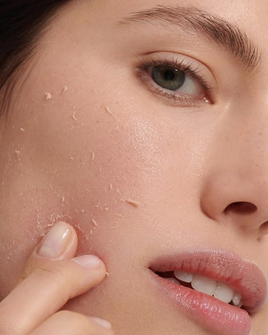 How to Fade Acne Marks and Achieve a More Even Skin Tone