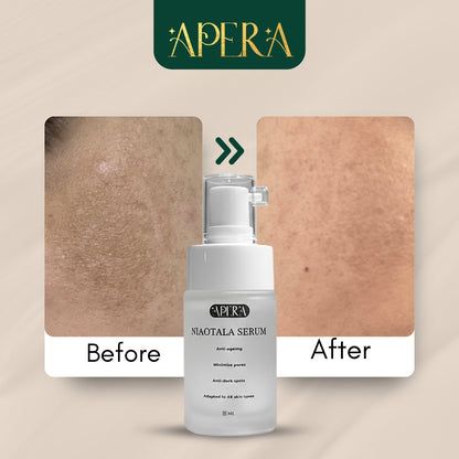 Apera Niaotala Serum  To moisturize the skin