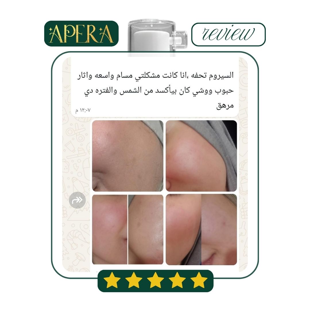 Apera Niaotala Serum  To moisturize the skin
