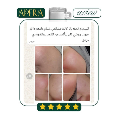 Apera Niaotala Serum  To moisturize the skin